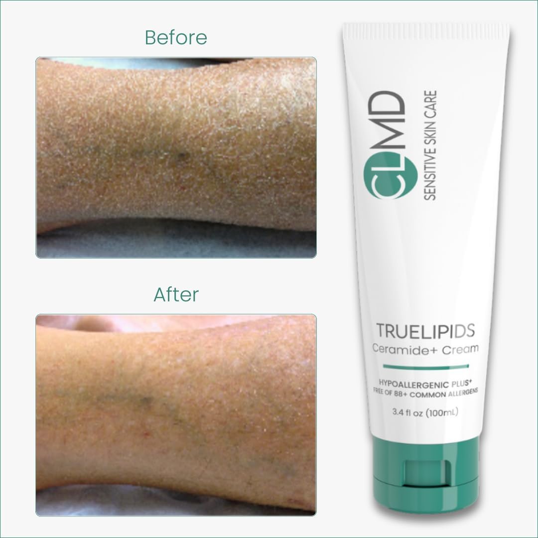 CLMD TrueLipids Ceramide+ Cream – Deep Moisturizing Barrier Support for Sensitive Skin – Hydrates and Soothes – Hypoallergenic, Nourishing, and Dermatologist-Tested – 3.4 fl oz